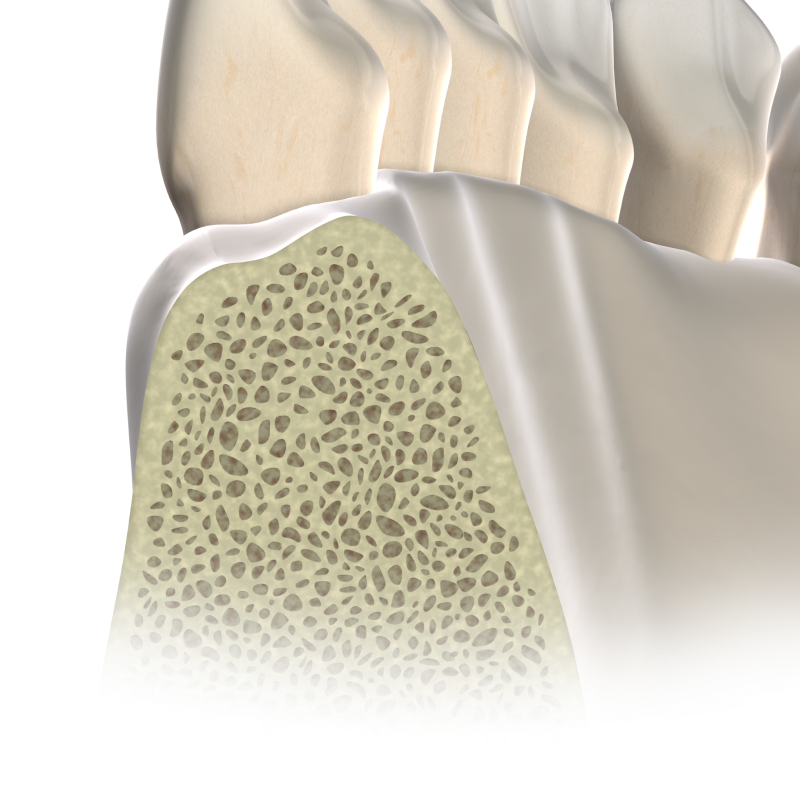 Isolated apicoectomy mobile