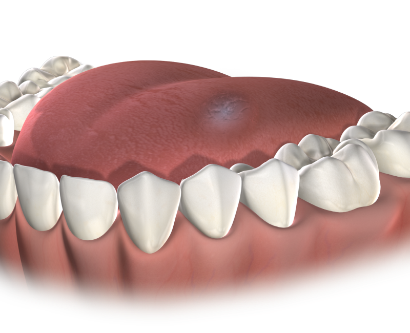 Isolated oral pathology mobile