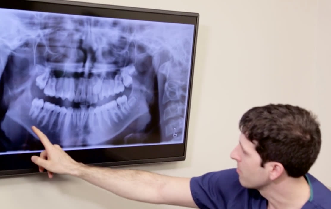 Dr. Fasi pointing at an X-ray